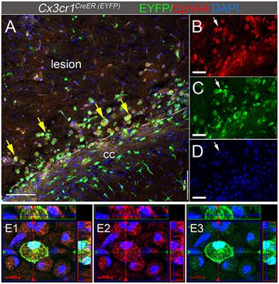 Conditional Deletion of EphA4 on Cx3cr1-Expressing Microglia Fails to Influence Histopathological Outcome and Blood Brain Barrier Disruption Following Brain Injury